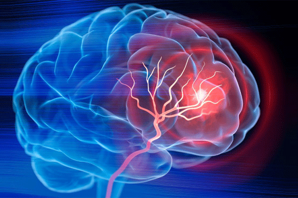 20261021 IN Stroke web